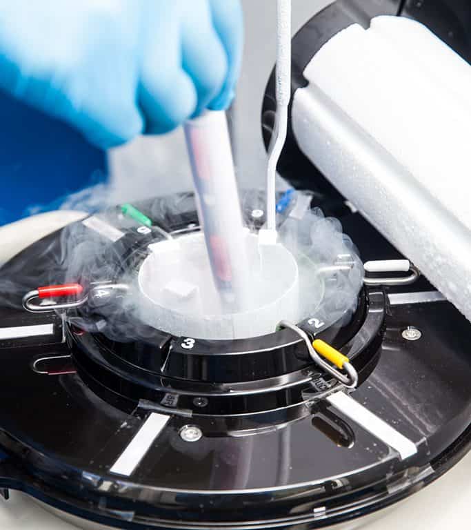 Cryopreservation Of Embryos