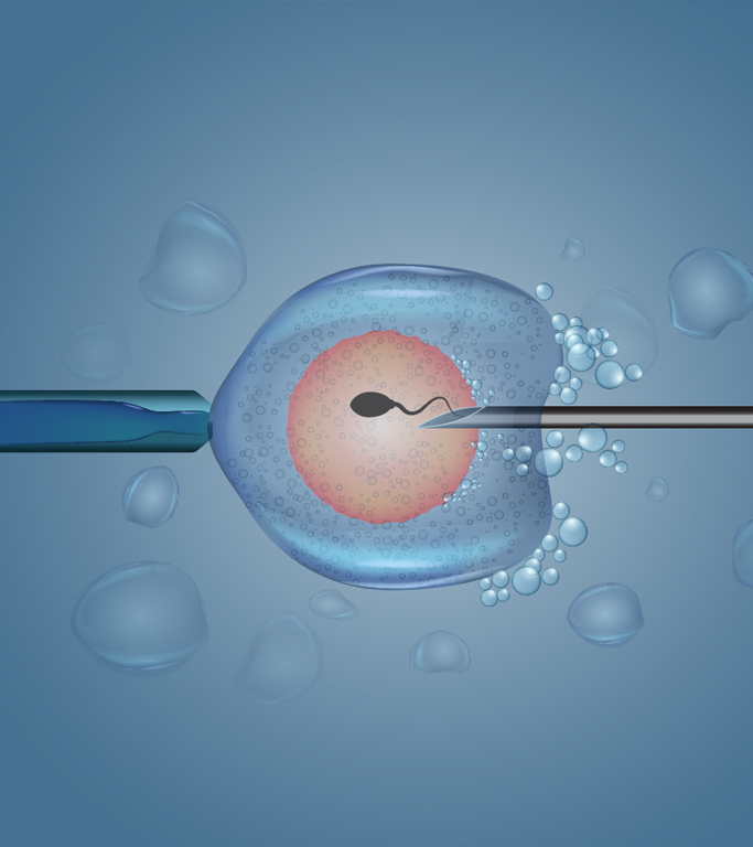 Illustration of laser-assisted hatching in IVF treatment process.