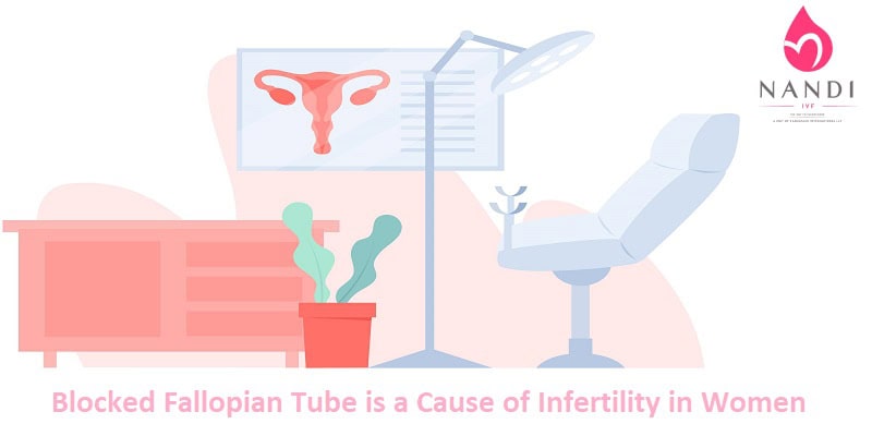 How Blocked Fallopian Tube is a Cause of Infertility in Women