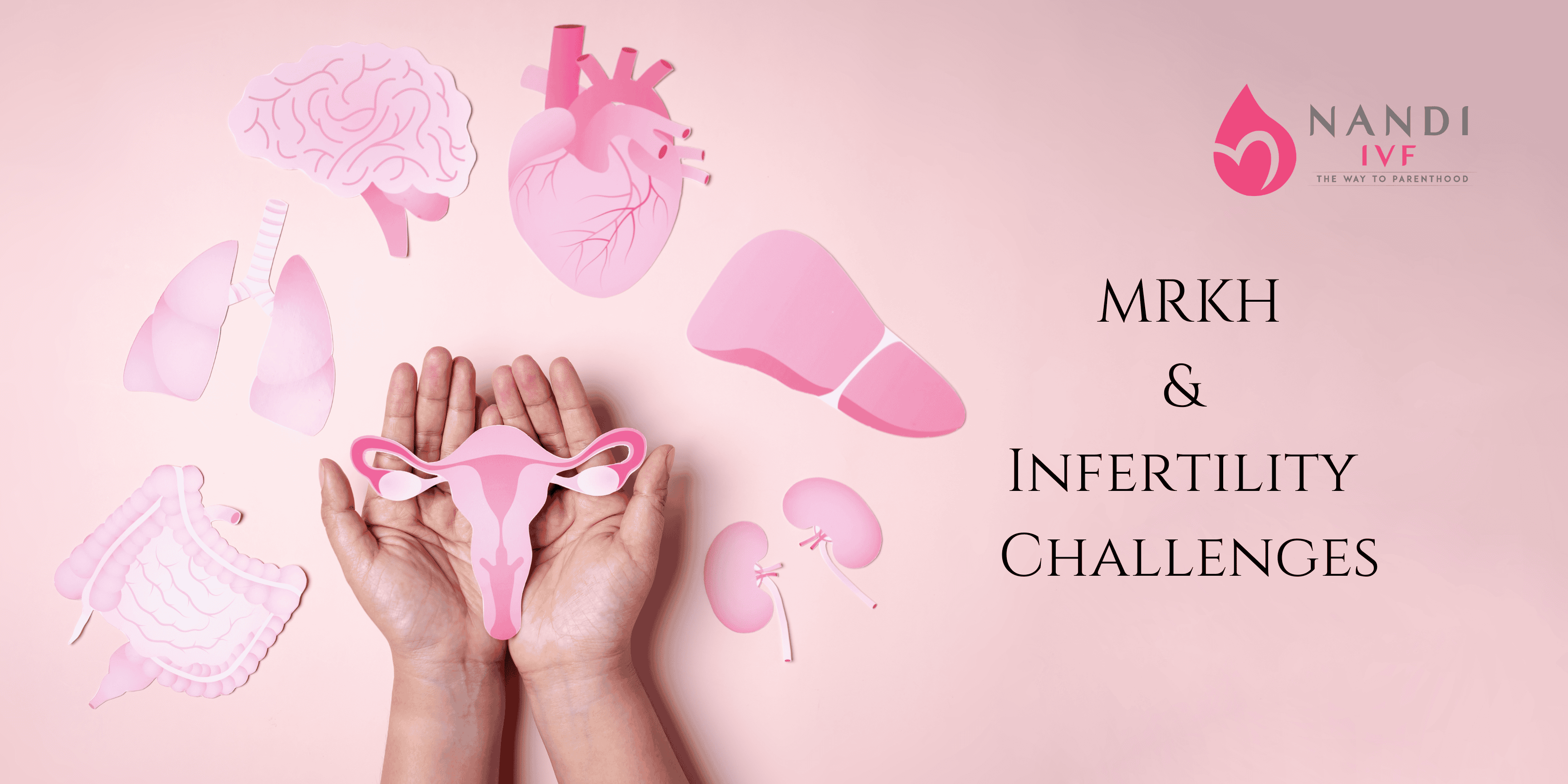 Illustration of female reproductive organs highlighting MRKH and infertility issues.