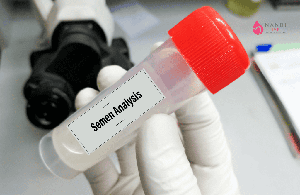 Semen analysis test tube with red cap for fertility testing.