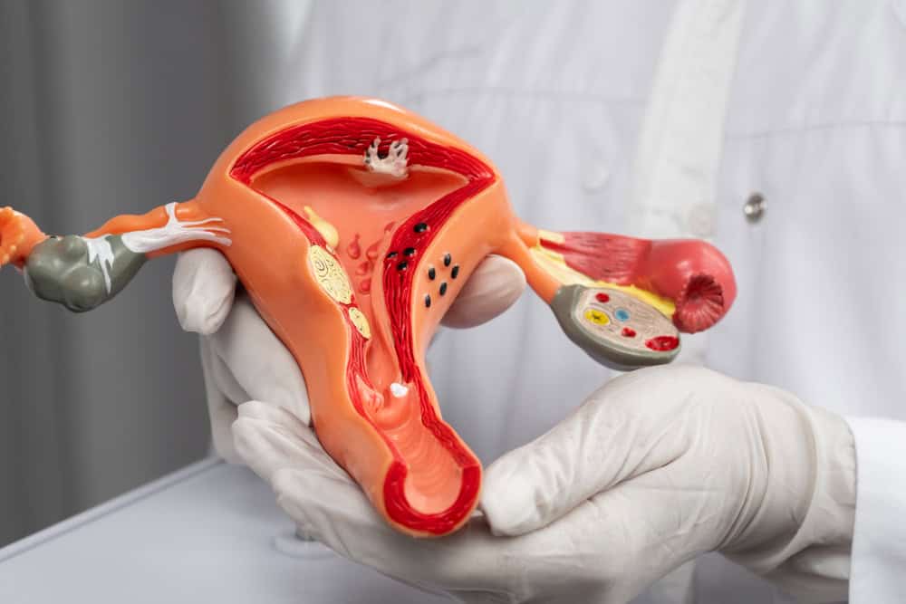 Uterine Transplantation