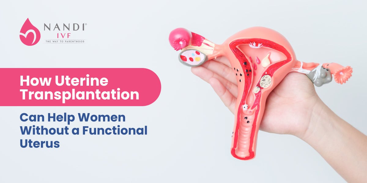 Model of a uterus showing transplant process for women without a functional uterus.