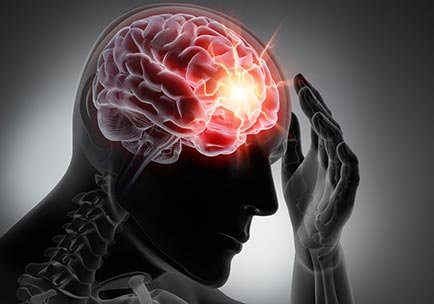 Brain Injuries