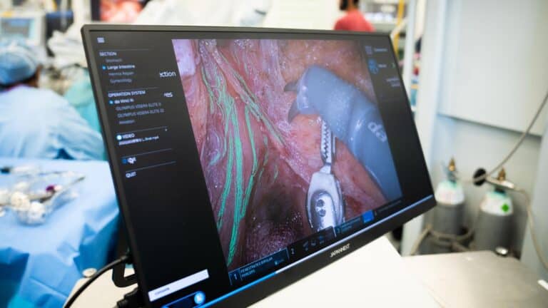 AI-powered surgery tool UK