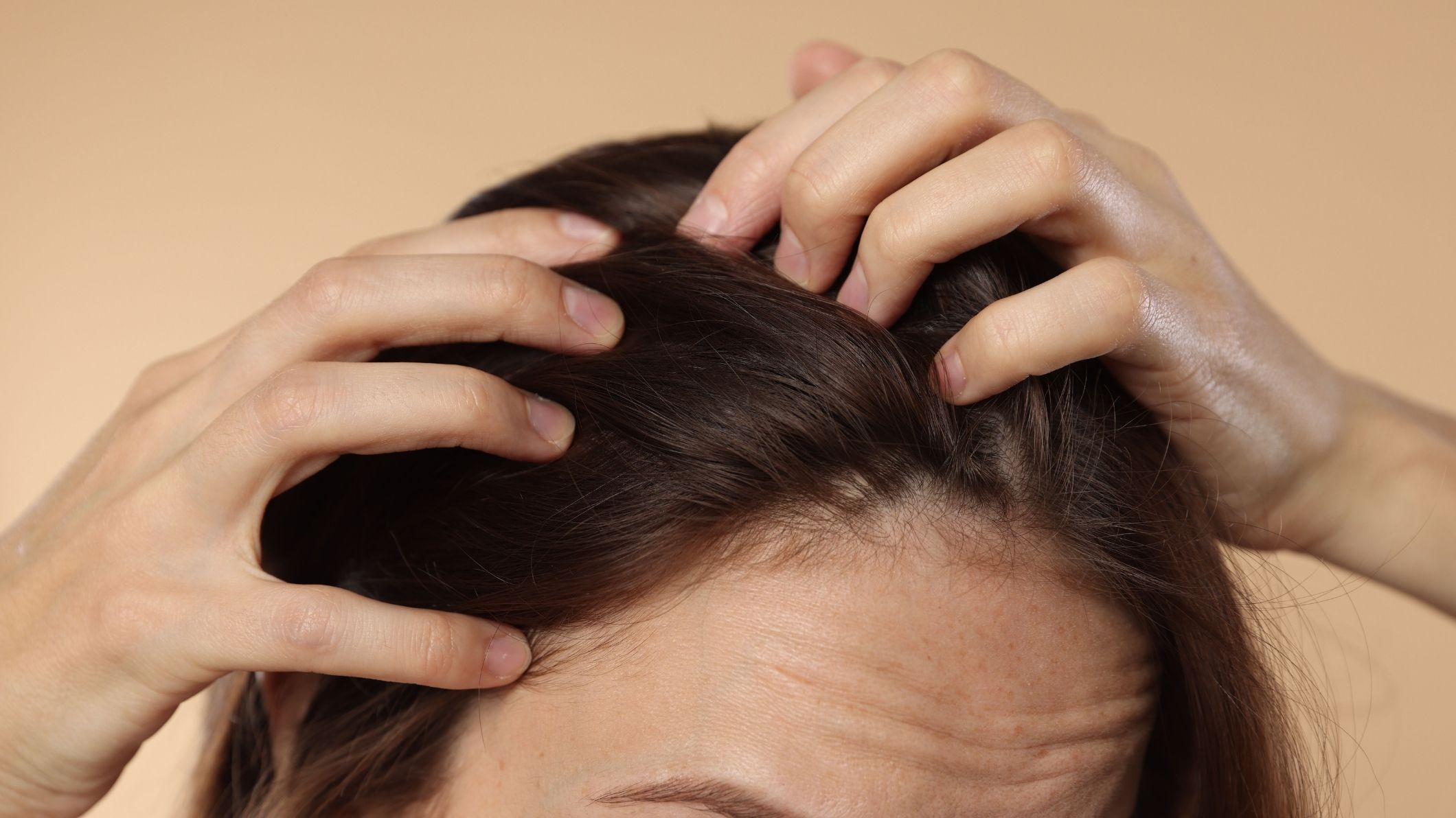 Scalp Trauma