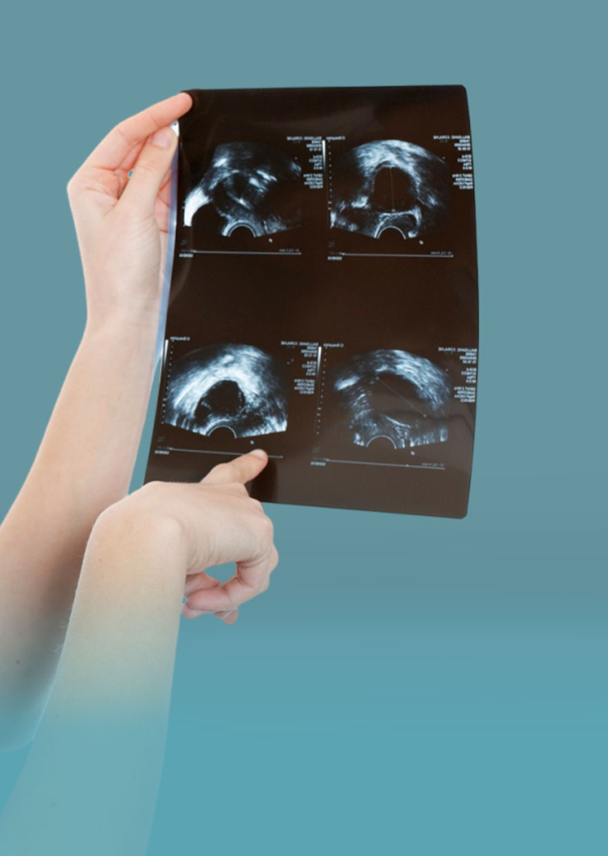 Soft-Tissue-Ultrasound-Scan