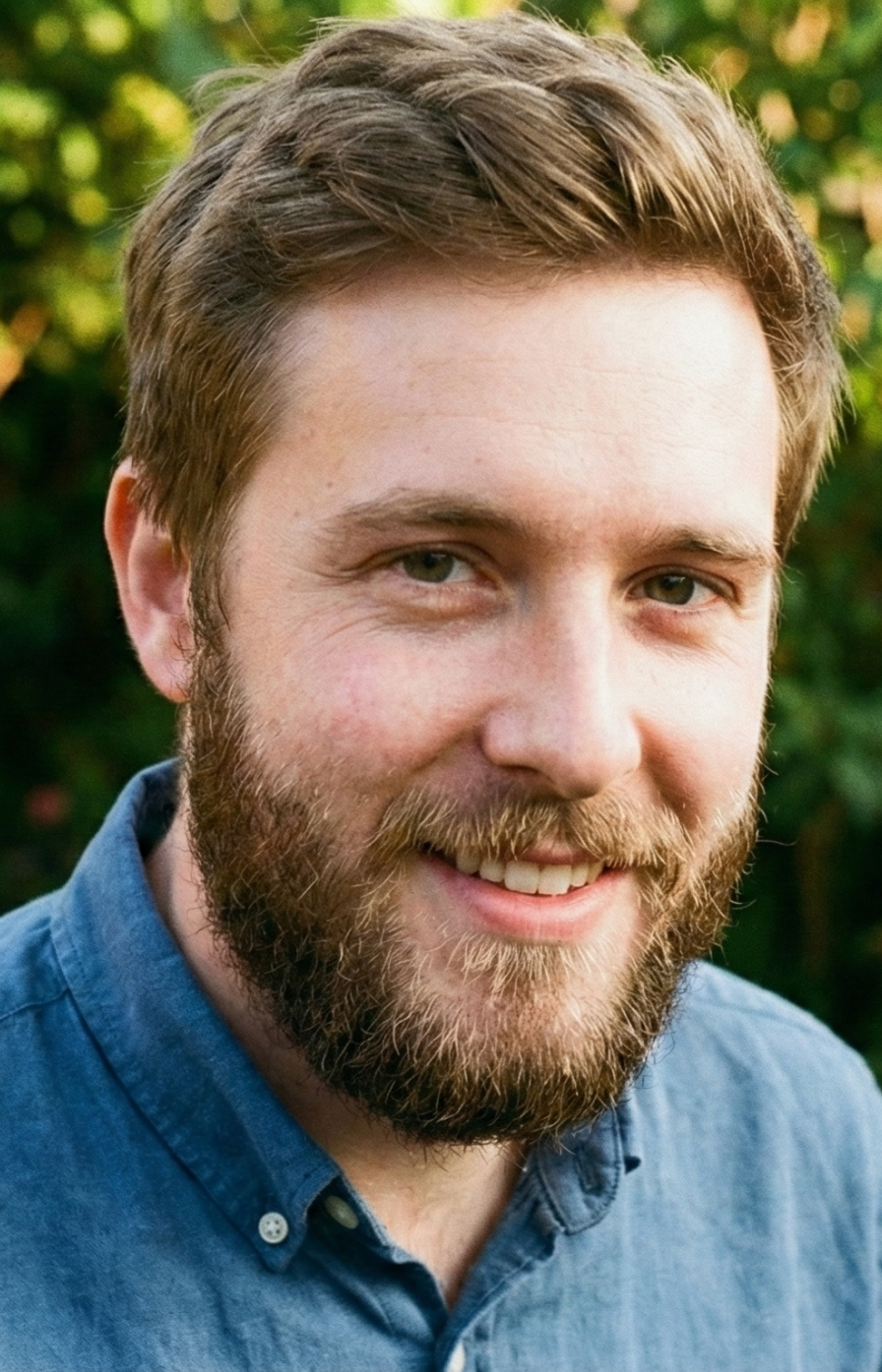 after beard transplant