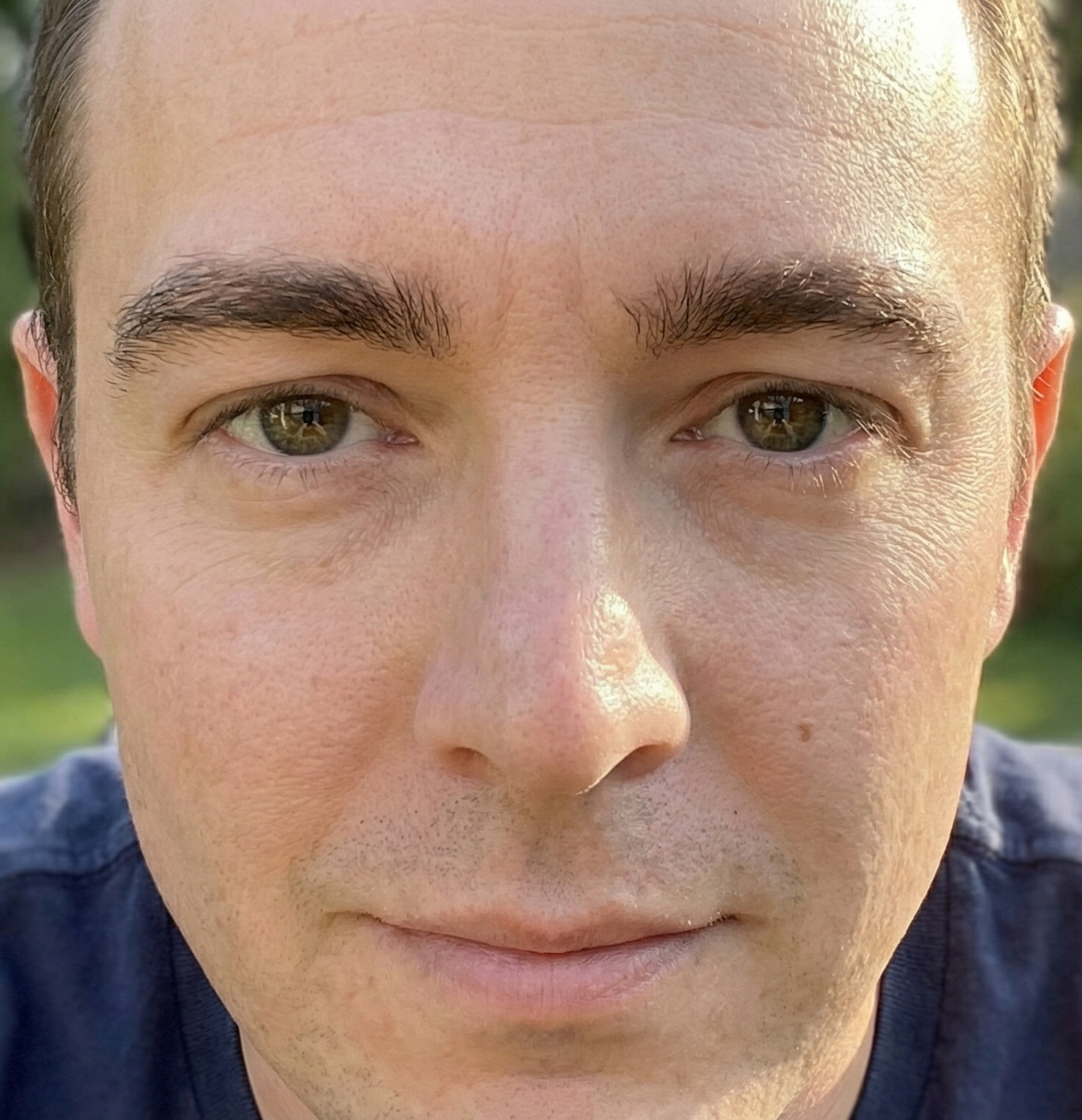 after eyebrow transplant