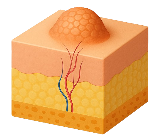 skin with warts