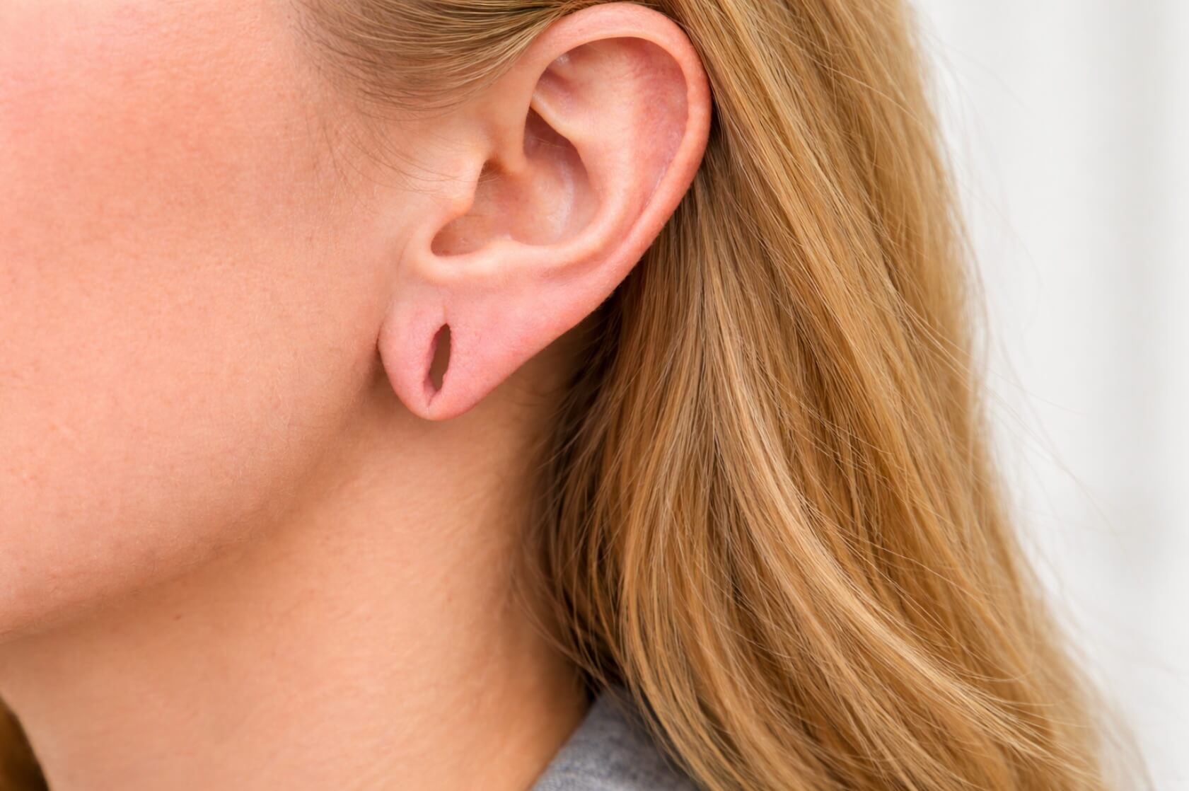 torn earlobes