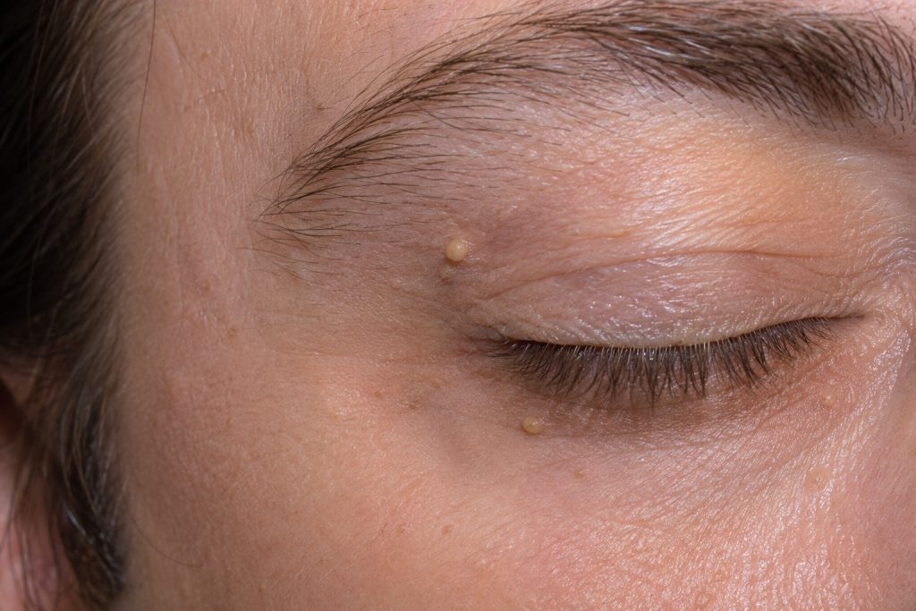 Detailed close-up of eyelid skin