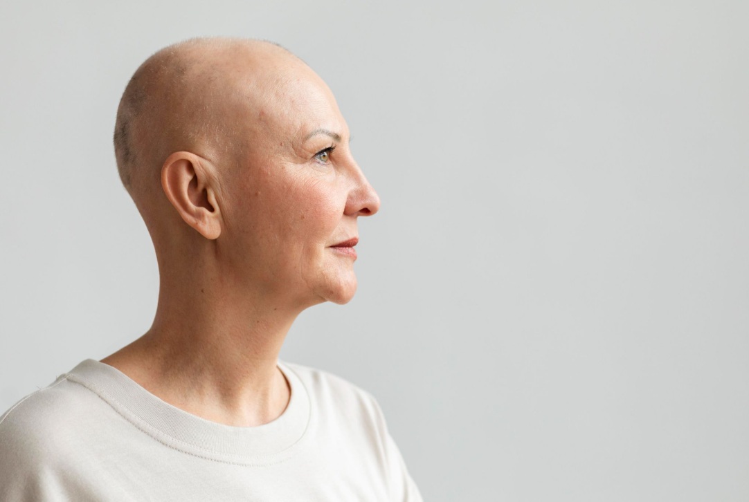 Skin Cancer on the Face