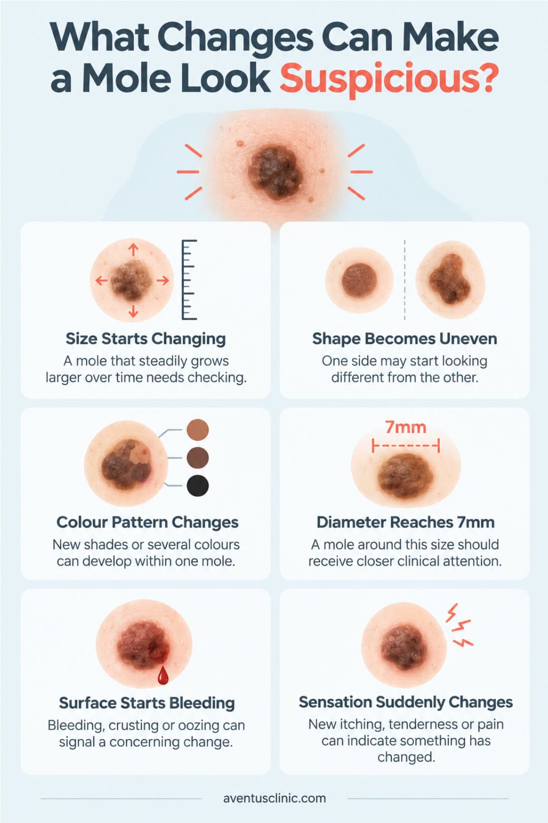 What changes can make a mole look suspicious