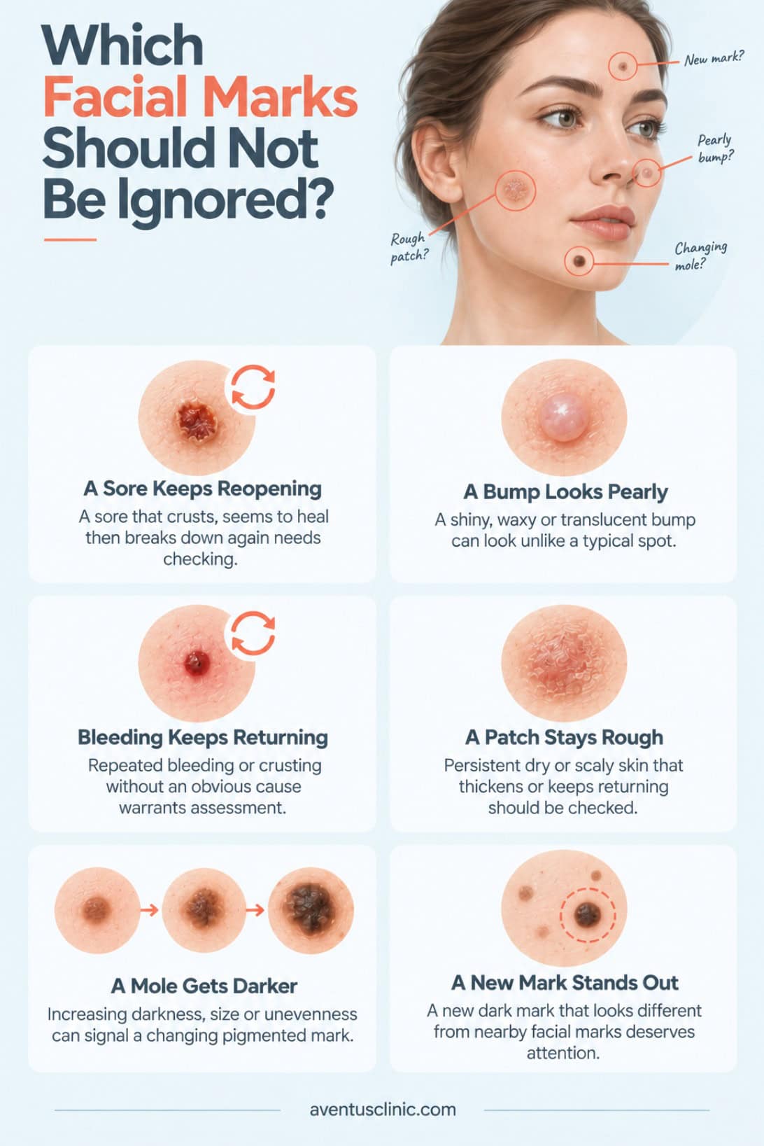 Which facial marks should not be ignored