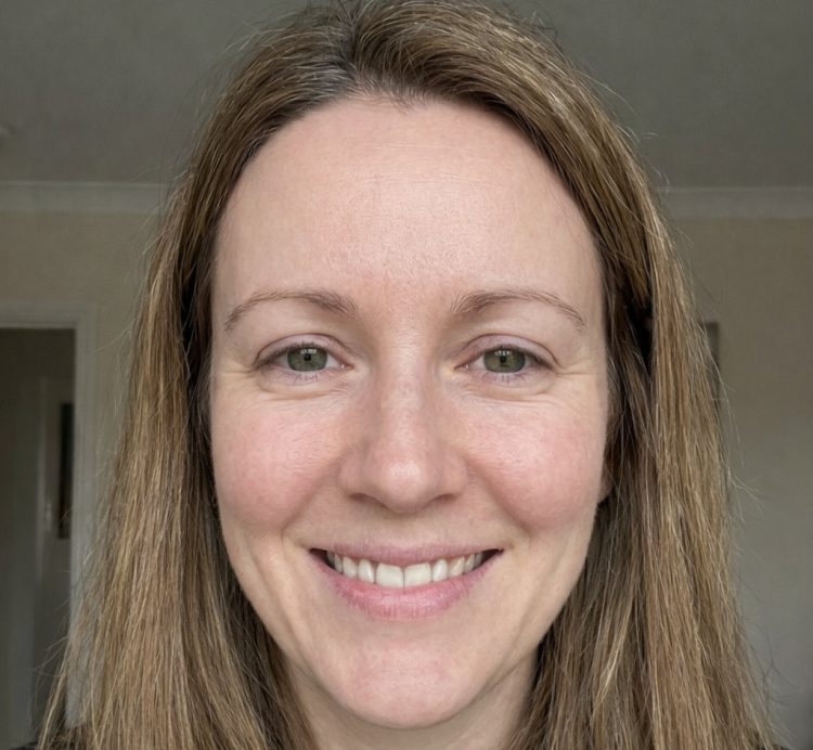 After Eczema Private Treatment