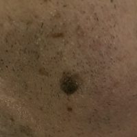 Mole closer look