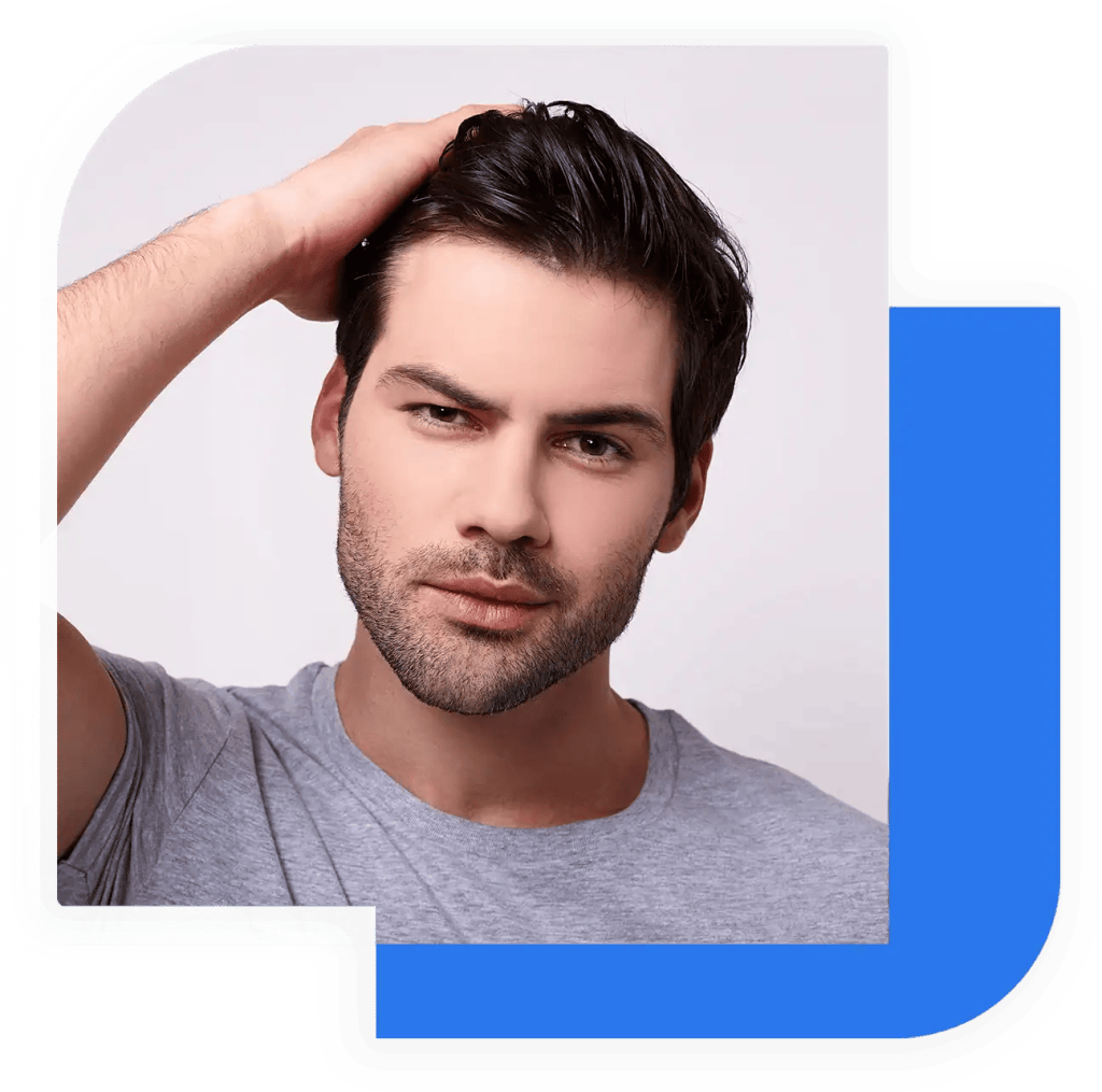 Risultato naturale di un trapianto di capelli e barba su un uomo giovane presso la clinica Clinic Prime