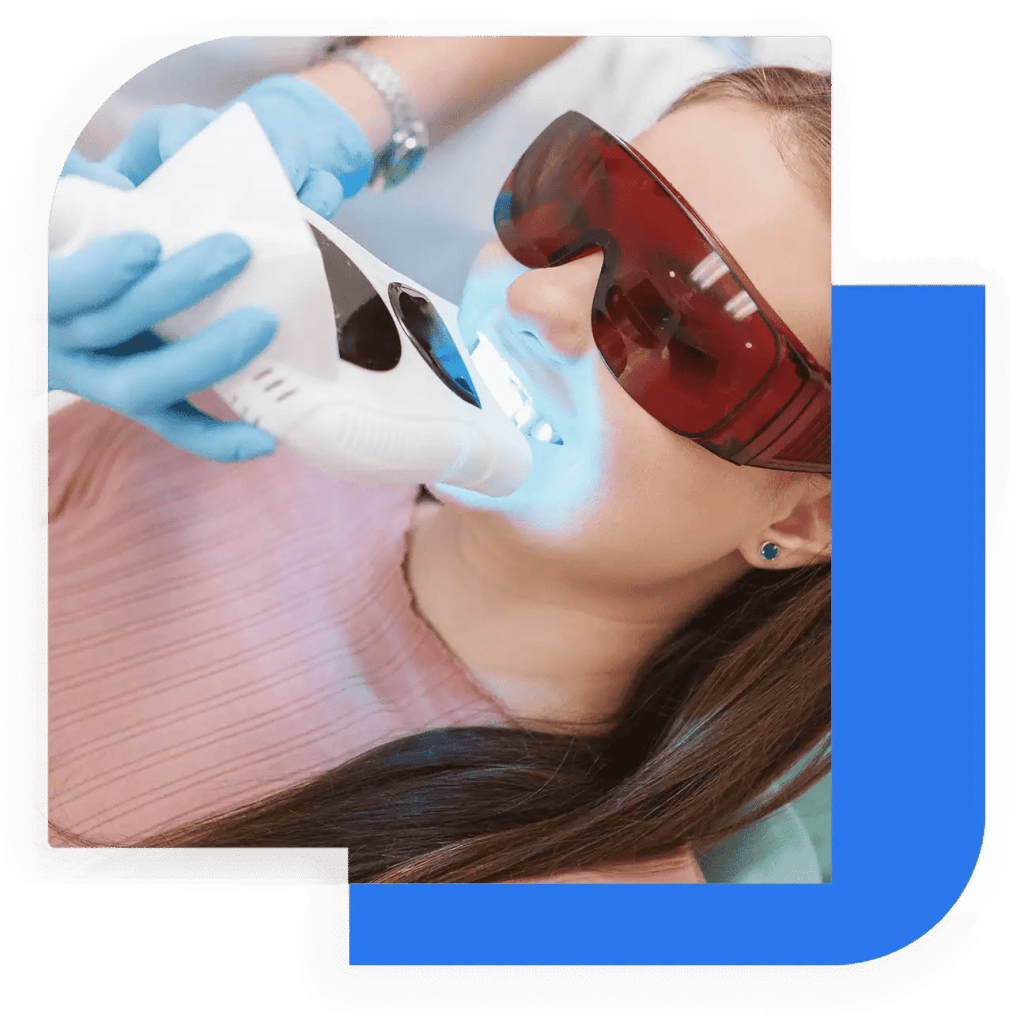 Paziente sottoposta a trattamento di sbiancamento dentale professionale in una clinica odontoiatrica