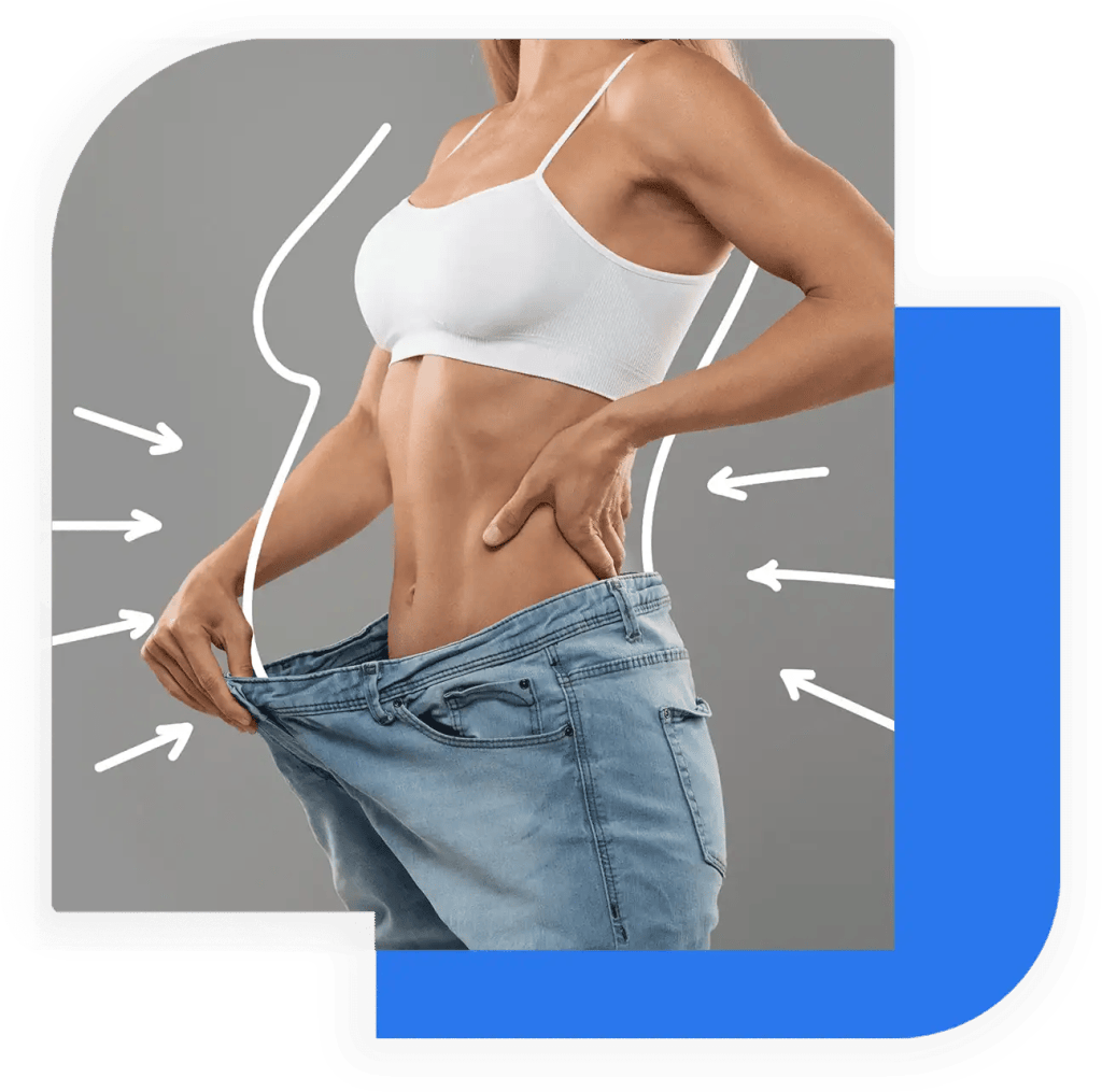 Silhouette di una donna dopo chirurgia bariatrica e perdita di peso con Sleeve Gastrectomy in Turchia