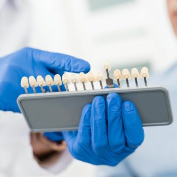 Sélection de teinte pour implants et facettes dentaires à la clinique EsteCapelli Istanbul Main gantée tenant un nuancier de teintes dentaires pour correspondre à la couleur des implants ou facettes
