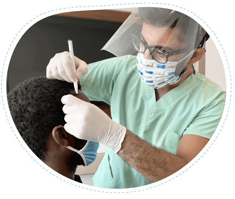 Procédure de greffe capillaire à la clinique EsteCapelli Istanbul Médecin de la clinique EsteCapelli réalisant une greffe de cheveux sur un patient avec équipement de protection
