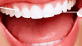 pulizia-denti