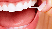 pulizia-denti