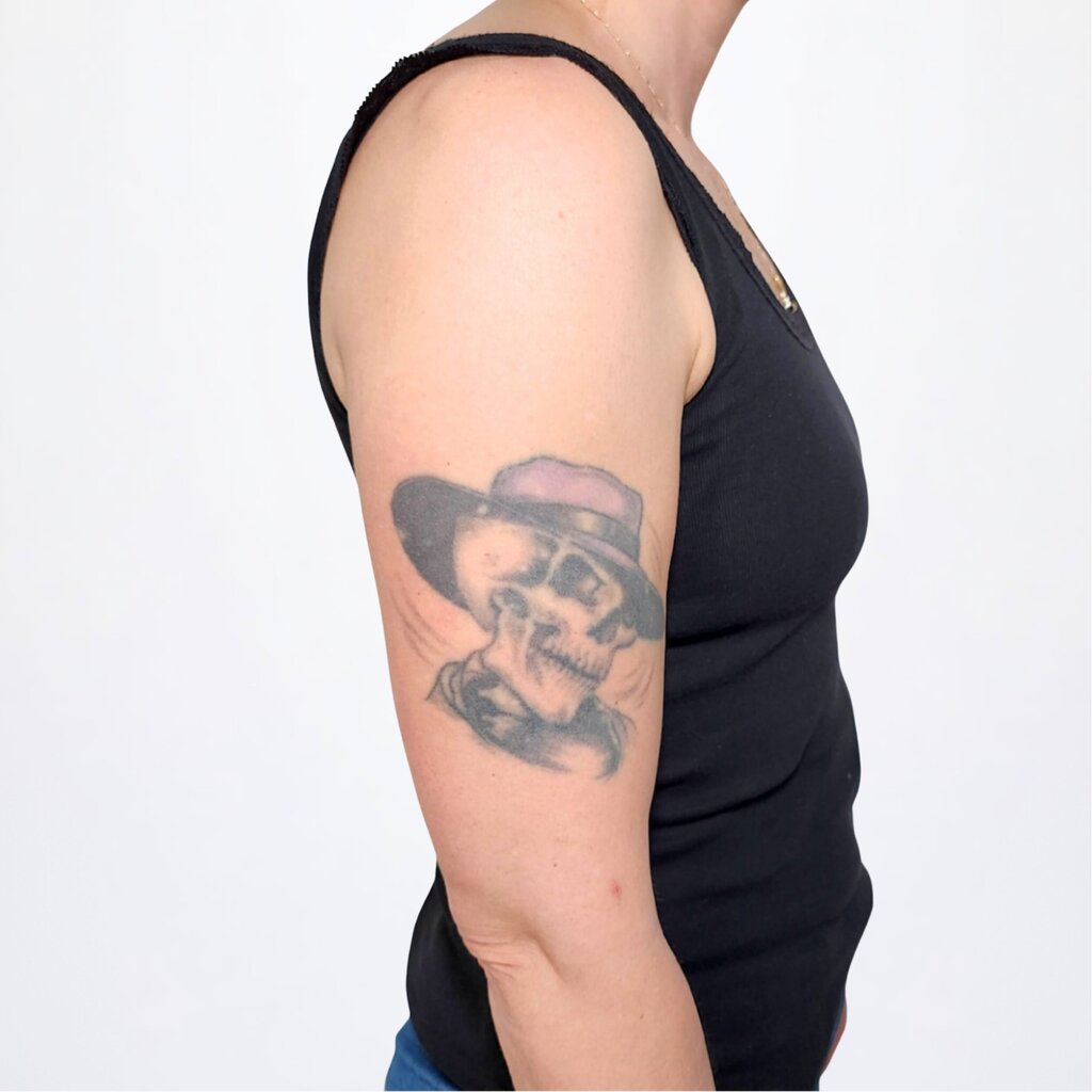 Altes verblasstes Skelett-Tattoo mit Hut auf dem Oberarm vor dem Cover-Up in Widnau.