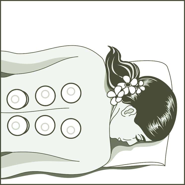 Cupping Honolulu Hawaii