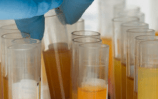 plasma iperimmune avis bologna