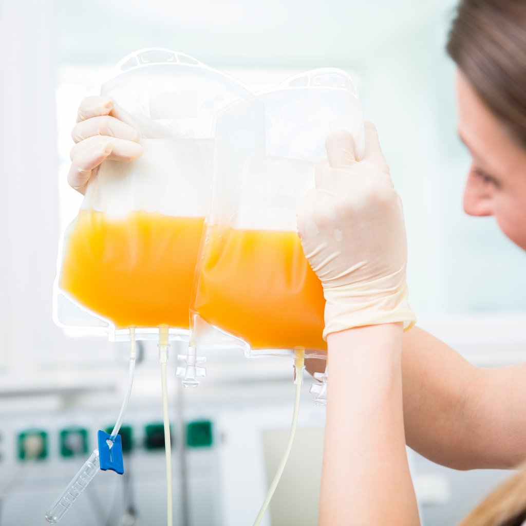 donazione multicomponent avis bologna