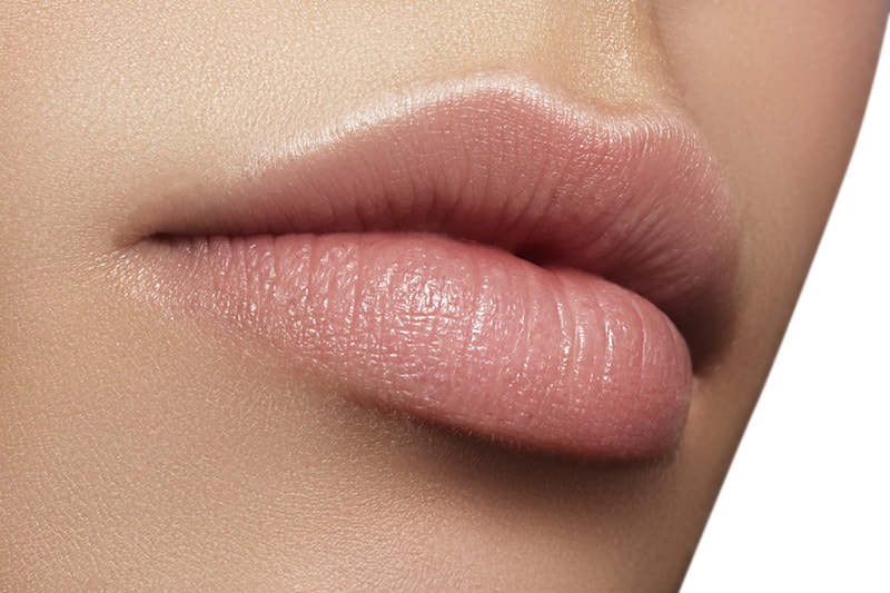 Filler labbra a Limbiate