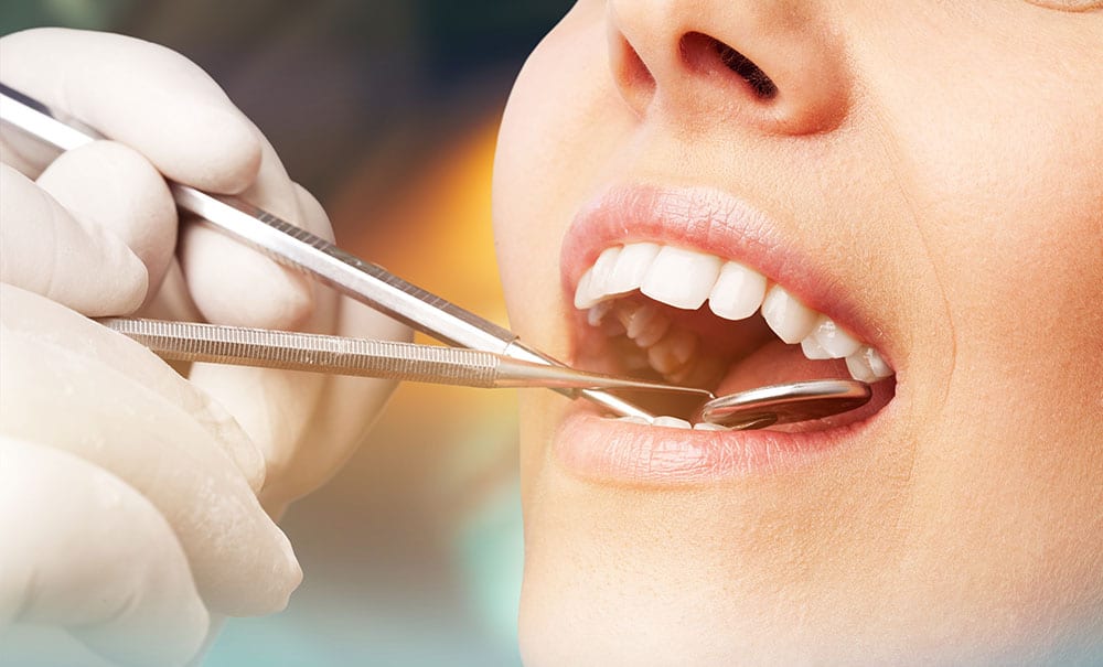 Di cosa si occupa l’implantologia dentale?