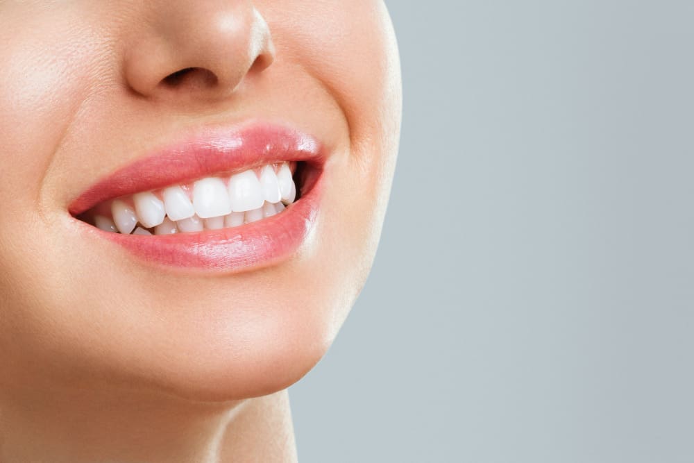 Come avere denti bianchi dal dentista