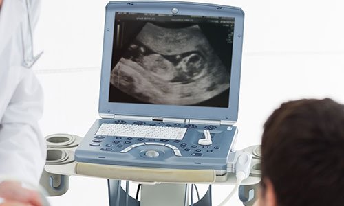 ultrasound
