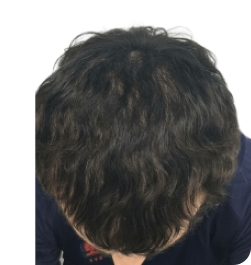 After