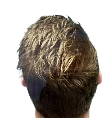 After