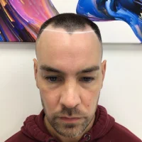 Ben-Before.webp