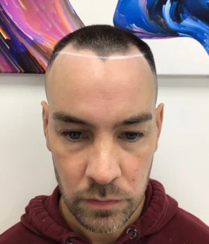 Ben-Before.webp