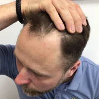 Lee-Before