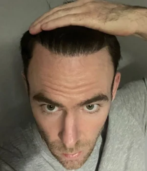 Stephen-After.webp