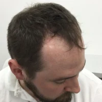 Thomas-Before.webp