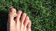 Come curare la micosi alle unghie