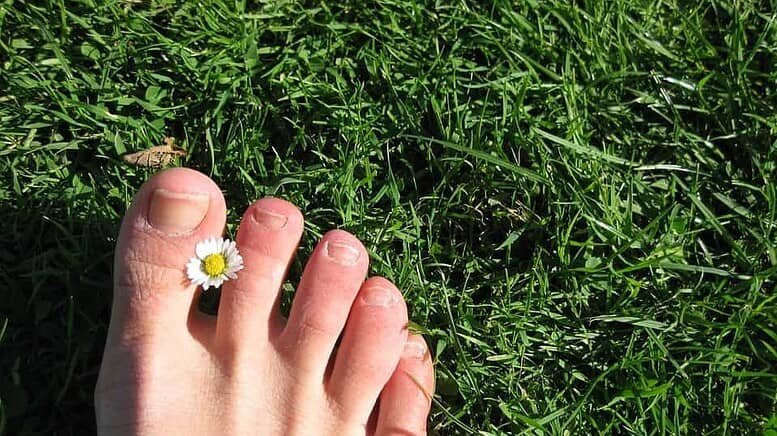 Come curare la micosi alle unghie