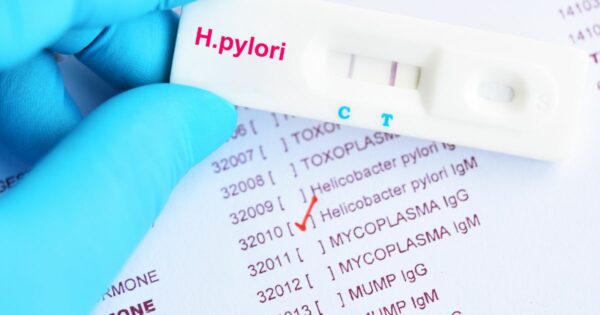 h pylori lab testing