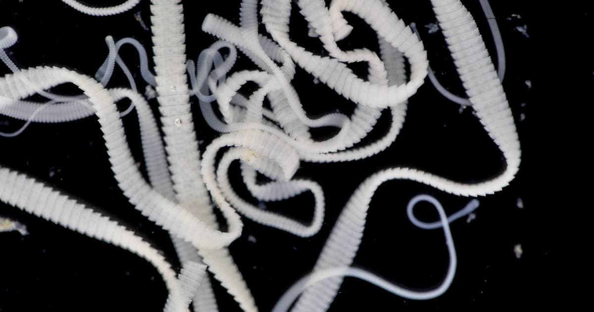 tapeworm