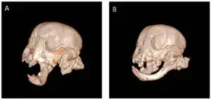 Side-by-side 3D CT scans showing a French bulldog’s jaw before and after regrowth — a powerful example featured in inspiring dog stories on The Wag Report.