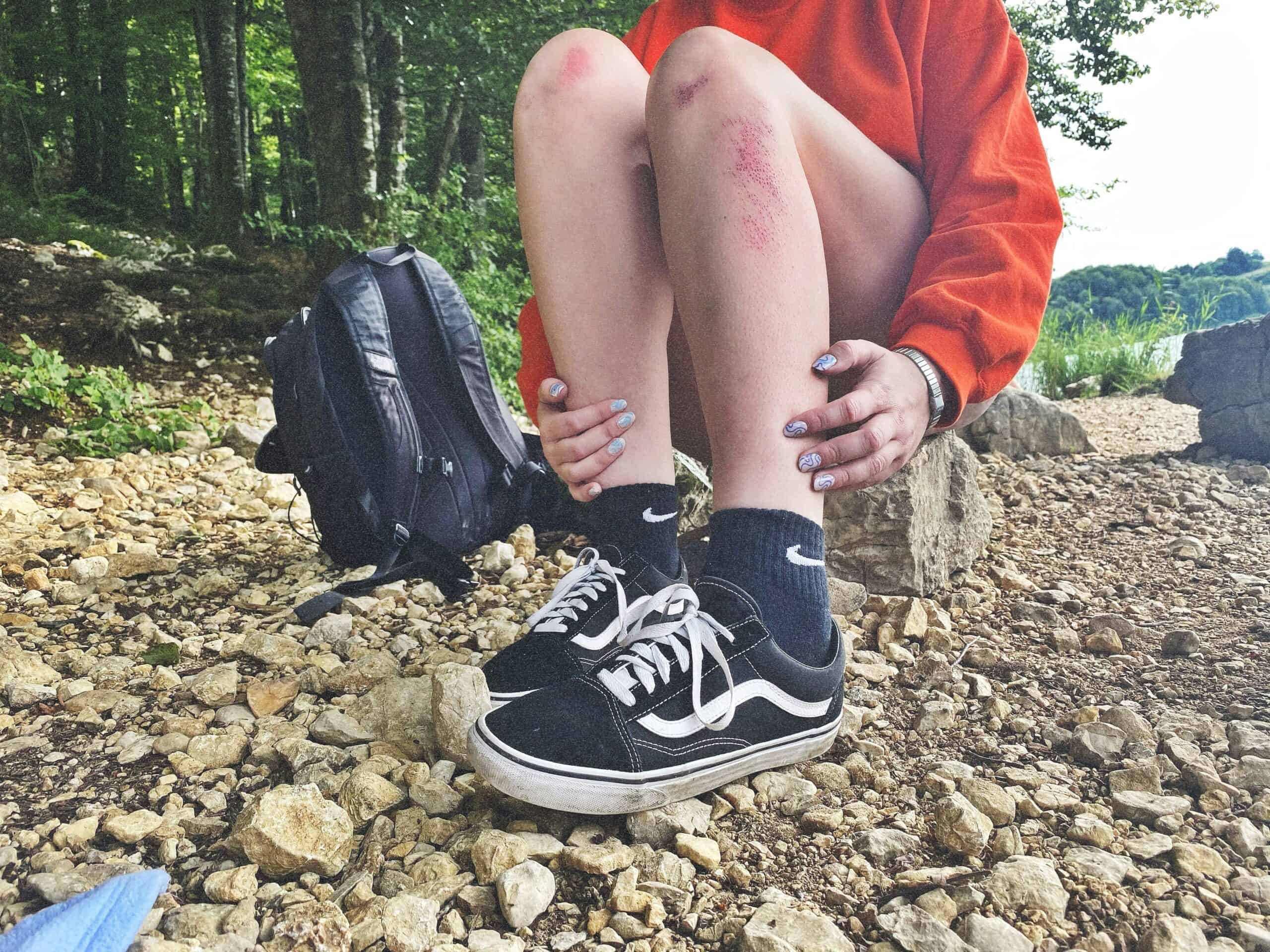 Why Do My Feet Hurt After Hiking?
