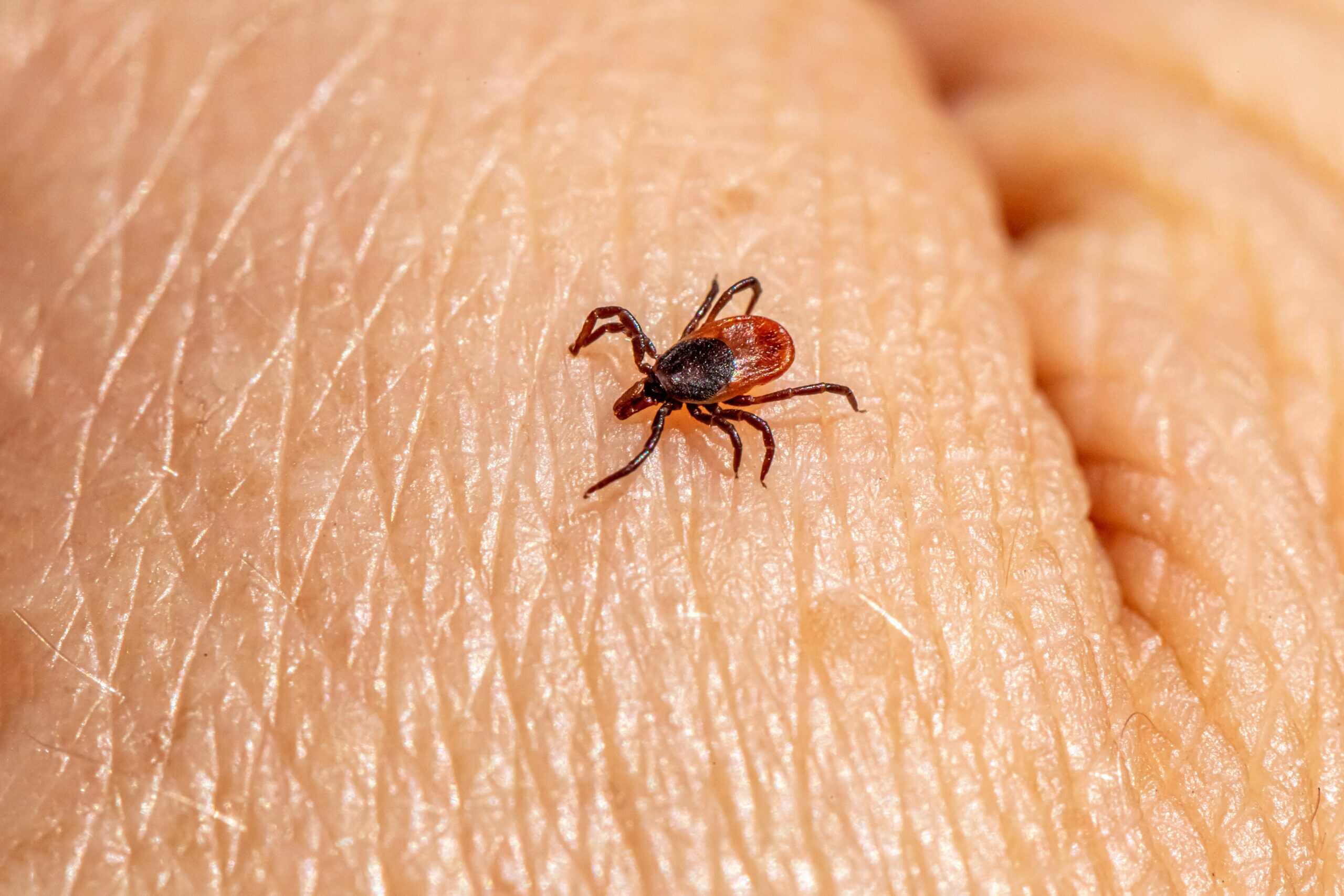 How to Check for Ticks After a Hike: Where They Hide and What to Do Next